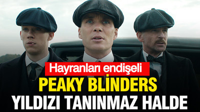 Peaky Blinders yıldızı tanınmaz halde: Hayranları endişeli