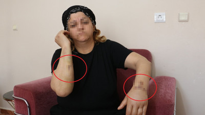 16 yıl sonra 30 bıçak darbesi: Talihsiz kadın kan revan içinde hastaneye ulaştı