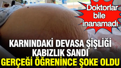 Karnındaki devasa şişliği kabızlık sandı, gerçeği öğrenince şoke oldu: Doktorlar bile inanamadı