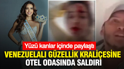 Venezuelalı güzellik kraliçesine otel odasında saldırı: Yüzü kanlar içinde paylaştı