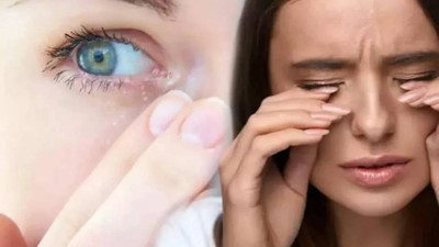 Uzman isim uyardı: ‘Ultraviyole ışınları korneaya zarar verebilir’