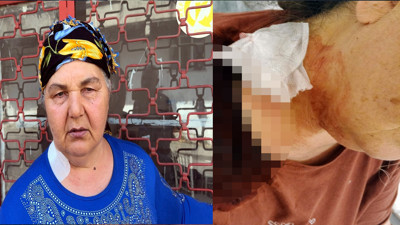 Yüzünü unuttuğu eski eşi iş yerini bastı: "Benim derdim seninle" diyerek bıçakladı