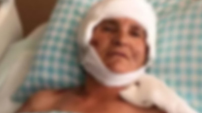 9 köpeğin saldırısına uğramıştı: 7 yıl sonra Yargıtay’dan 637 bin TL’lik karar