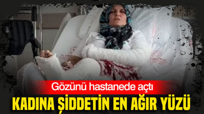 Kadına şiddetin en ağır yüzü: Gözünü hatanede açtı