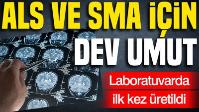 ALS ve SMA için dev umut... Laboratuvarda ilk kez üretildi