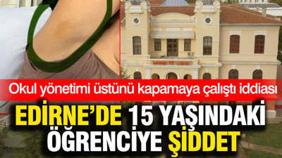 Edirne'de 15 yaşındaki öğrenciye şiddet: Okul yönetimi üstünü kapamaya çalıştı iddiası