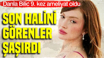 Danla Bilic 9. kez ameliyat oldu: Son halini görenler şaşırdı