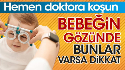 Bebeğin gözünde bunlar varsa dikkat. Hemen doktora koşun