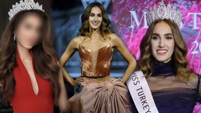 Estetik mi yaptırdı? Türkiye güzeli İdil Bilgen'in son hali kafa karıştırdı!