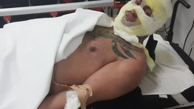 İş görüşmesi için gitti otelde kendini yaktı