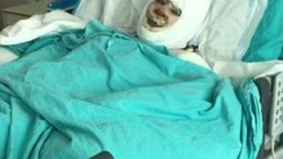 Karısıyla tartıştı kayınvalidesine benzin döküp yaktı