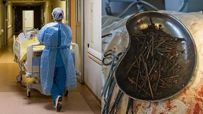 Doktorlar midesinden tek tek çıkardı. Kimse gözlerine inanamadı