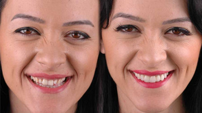 Diş hekimi özgüvenin sırrını açıkladı