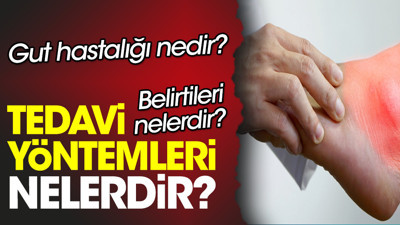 Gut hastalığı nedir? Belirtileri nelerdir? Tedavi yöntemleri nelerdir?