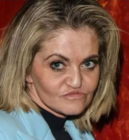 Uyuşturucu bağımlılığı oyuncunun hayatını bitirdi! Burun kemiği yok oldu - Resim : 4