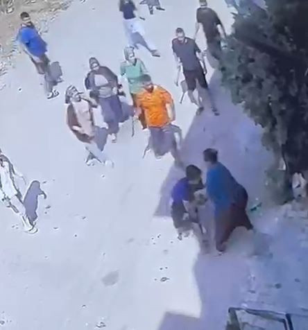 Keser, bıçak ve zincirlerle kapıya dayandılar: Adana'da komşu kavgası - Resim: 6