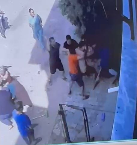 Keser, bıçak ve zincirlerle kapıya dayandılar: Adana'da komşu kavgası - Resim: 7