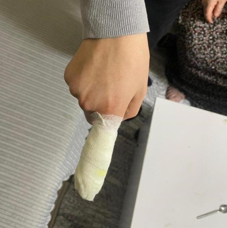 Ekmek almaya giden 14 yaşındaki çocuğu ''hırsız'' diye öldüresiye dövdüler - Resim : 1