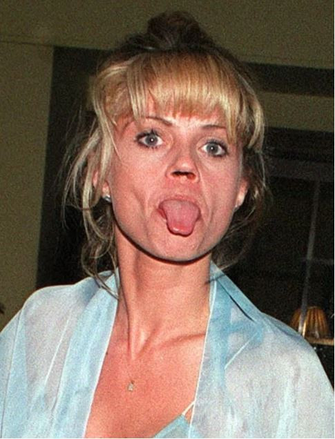 Uyuşturucu bağımlılığı oyuncunun hayatını bitirdi! Burun kemiği yok oldu - Resim : 6