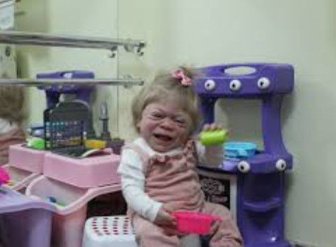 Hastalığın taşıyıcısı anne ve baba çıktı: 'Tanıyı duyunca dünyam başıma yıkıldı' - Resim: 11