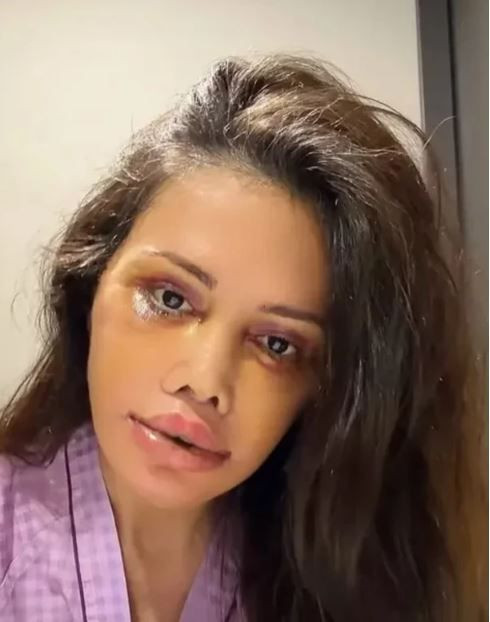 Survivor’ın eski yarışmacısı Didem Ceran’dan yürek burkan haber: Yüz nakli olmuştu - Resim: 8