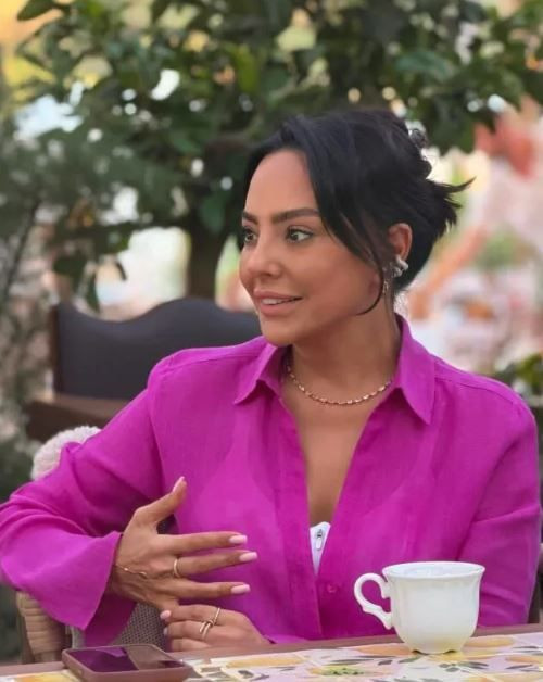 Ebru Gündeş'ten 10 milyon TL'lik değişim: Yüzünü gerdirdi son halini paylaştı - Resim: 2