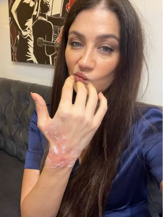 Eşref Rüya çekimlerinde talihsiz kaza: Ünlü oyuncu elinden yaralandı - Resim : 2