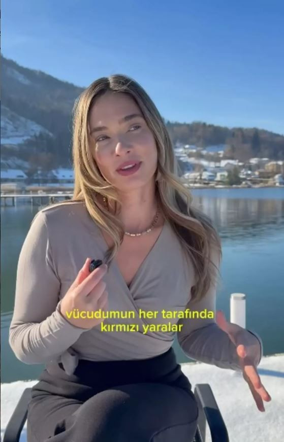 Müge Boz gizlediği büyük sırrı açıkladı: 20 yıldır bu hastalıkla savaş veriyorum - Resim: 3