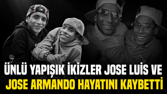 Ünlü yapışık ikizler Jose Luis ve Jose Armando 27 yaşında hayatını kaybetti