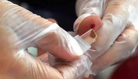 B Kan grubuna sahip olanlar dikkat: Risk %28 daha fazla - Resim: 8