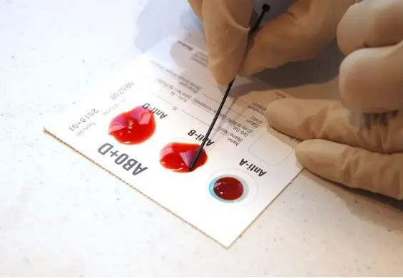 B Kan grubuna sahip olanlar dikkat: Risk %28 daha fazla - Resim: 5