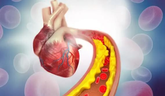 Zerdeçalın gizli gücü: Sabahları aç karnına 1 kaşık tüketmek yetiyor - Resim: 6