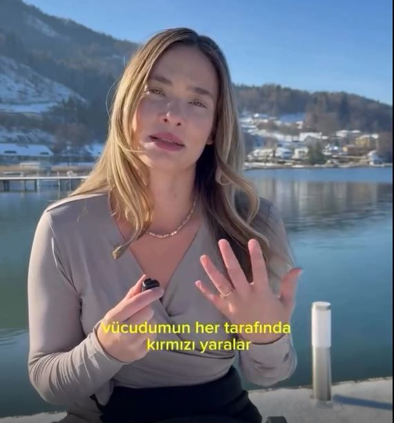 Müge Boz gizlediği büyük sırrı açıkladı: 20 yıldır bu hastalıkla savaş veriyorum - Resim: 20