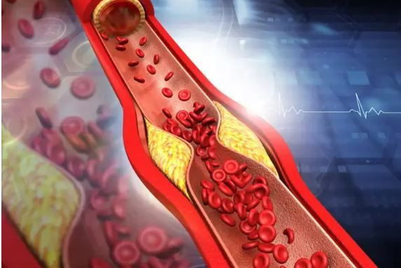 Zerdeçalın gizli gücü: Sabahları aç karnına 1 kaşık tüketmek yetiyor - Resim: 5
