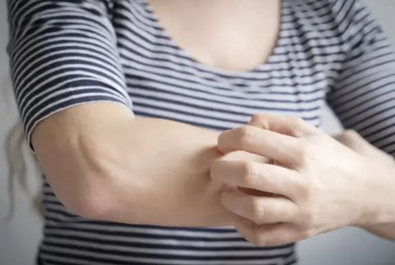 Yaz gecelerinin kabusu bitiyor: Bunu yapınca sivrisinekler yanınıza bile yaklaşmıyor - Resim: 1