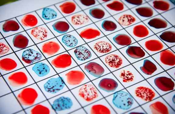 Lider mi, özgür ruh mu? Kan grubun karakterini açıklıyor - Resim: 3