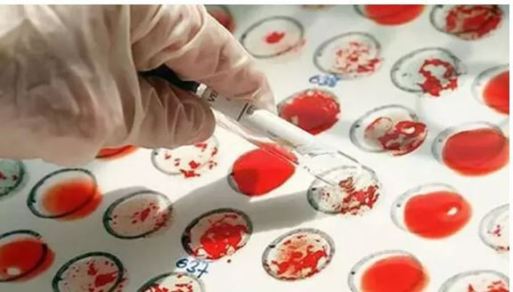 Lider mi, özgür ruh mu? Kan grubun karakterini açıklıyor - Resim: 1