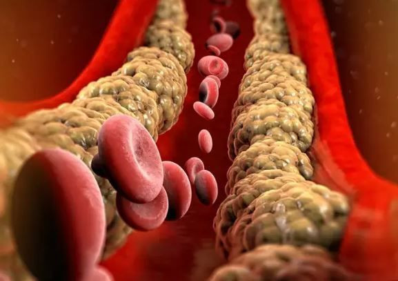 Zerdeçalın gizli gücü: Sabahları aç karnına 1 kaşık tüketmek yetiyor - Resim: 4