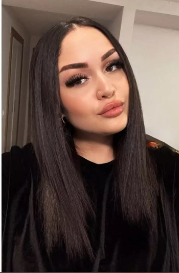 Hüsnü Şenlendirici'nin kızı Naz Şenlendirici’yi gören tanıyamadı: Ameliyat sonrası bambaşka biri oldu - Resim: 2