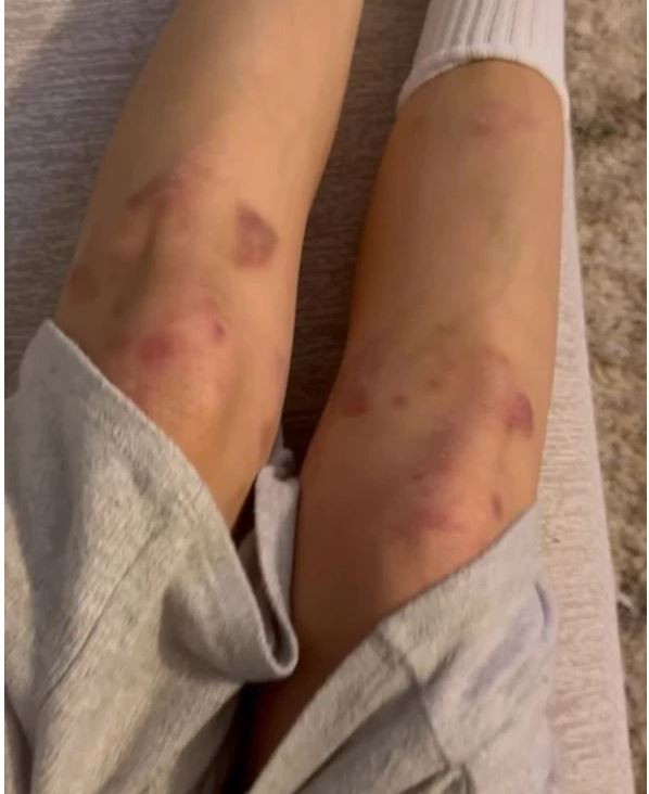 Seray Kaya’nın direk dans performansı olay oldu: Sınırları zorladı - Resim : 3