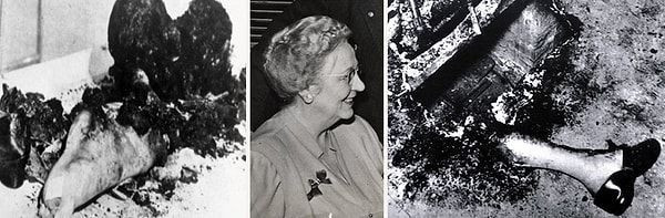 İnsanlar neden yokken kendiliğinden yanması gizemini bilim dünyası çözdü - Resim: 11