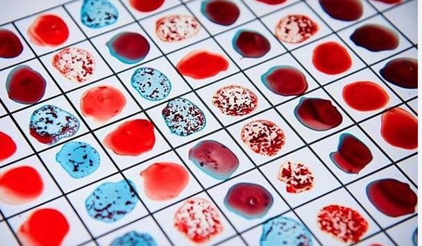 En güçlü bağışıklık hangi kan grubunda? Gerçekler şaşırtıyor - Resim: 2