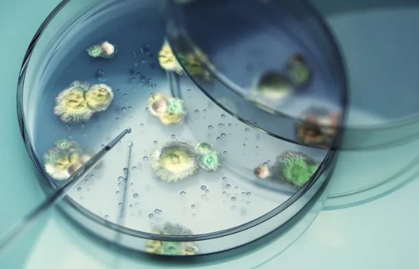 Kuzey İrlanda’da ürperten keşif: Örümcekleri zombiye dönüştürüyor - Resim: 4