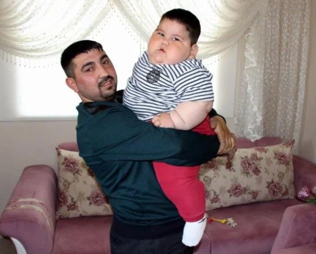 Yağız'ın mucizevi değişimi: 5 yaşında 90 kiloydu, şimdi görenler tanıyamıyor - Resim: 1