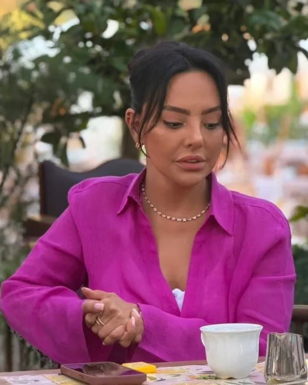 Ebru Gündeş'ten 10 milyon TL'lik değişim: Yüzünü gerdirdi son halini paylaştı - Resim: 4
