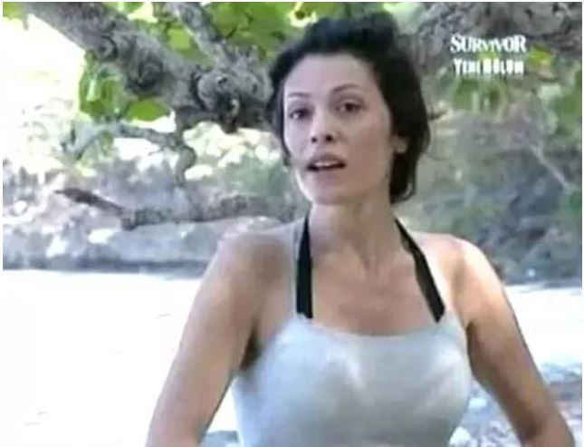 Survivor’ın eski yarışmacısı Didem Ceran’dan yürek burkan haber: Yüz nakli olmuştu - Resim: 1