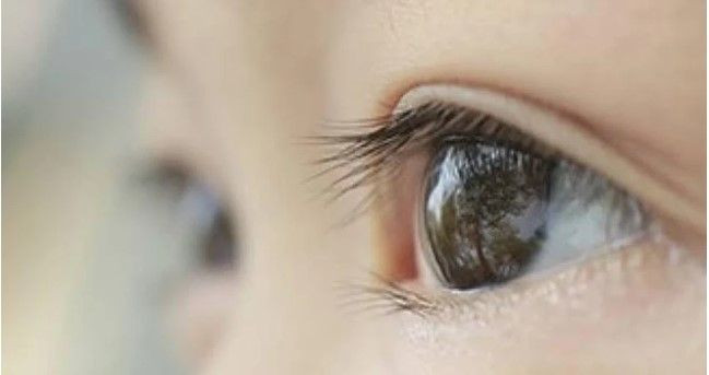 Gözde ışık çakmasına dikkat: Körlük riskine karşı uzmandan hayati uyarı - Resim: 5