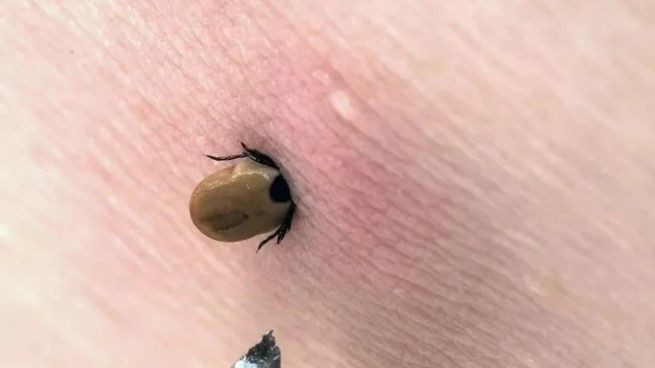 Bir kenti korkutan olay: 5 kişi aynı nedenden hayatını kaybetti - Resim: 1