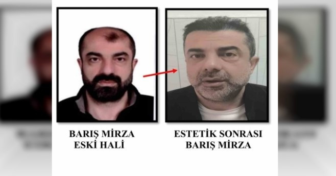 Ameliyat ile yüzünü değiştiren firari cinayet zanlısı yıllar sonra yakalandı - Resim : 1