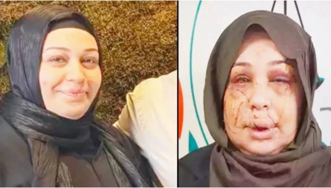 Eşine işkence yapan Cumhurbaşkanı Koruma Dairesi personeline ödül gibi ceza - Resim : 1